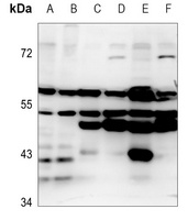 EMR4 Rabbit Polyclonal Antibody