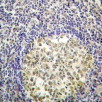 p47 phox (Phospho-S370) Rabbit Polyclonal Antibody