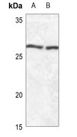 SFTPA1/2 Rabbit Polyclonal Antibody