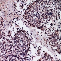 SFTPA1/2 Rabbit Polyclonal Antibody