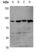 BMPR2 Rabbit Polyclonal Antibody
