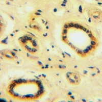 BMPR2 Rabbit Polyclonal Antibody