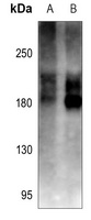 Cav1.2 Rabbit Polyclonal Antibody