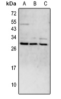 CD52 Rabbit Polyclonal Antibody