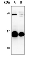 GM-CSF Rabbit Polyclonal Antibody