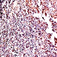 GM-CSF Rabbit Polyclonal Antibody