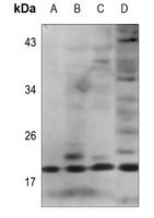 IL-2 Rabbit Polyclonal Antibody