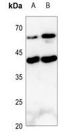 IL-9 Rabbit Polyclonal Antibody