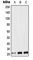 LIF Rabbit Polyclonal Antibody