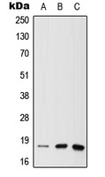 MTH1 Rabbit Polyclonal Antibody