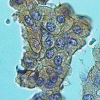 MUC4 Rabbit Polyclonal Antibody