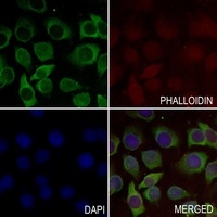 MUC4 Rabbit Polyclonal Antibody