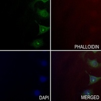 MYO7A Rabbit Polyclonal Antibody