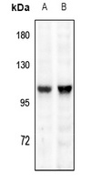 TRPV1 Rabbit Polyclonal Antibody