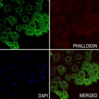 TRPV1 Rabbit Polyclonal Antibody