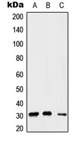 Gemin2 Rabbit Polyclonal Antibody