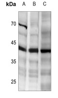 DR5 Rabbit Polyclonal Antibody