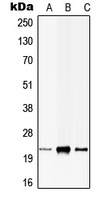 CIB1 Rabbit Polyclonal Antibody