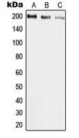 UBR2 Rabbit Polyclonal Antibody
