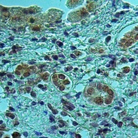 UBR2 Rabbit Polyclonal Antibody