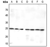 MED9 Rabbit Polyclonal Antibody