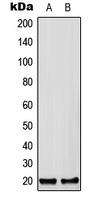 CFC1B Rabbit Polyclonal Antibody