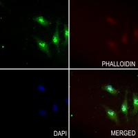 USP35 Rabbit Polyclonal Antibody
