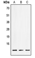 LSM2 Rabbit Polyclonal Antibody