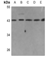 Collagen 26 alpha 1 Rabbit Polyclonal Antibody