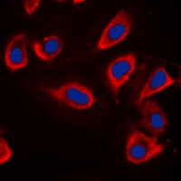 Alpha-adducin Rabbit Polyclonal Antibody