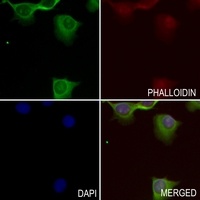 Adrenomedullin Rabbit Polyclonal Antibody