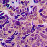 Beta Amyloid (Phospho-T743) Rabbit Polyclonal Antibody