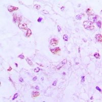 ATF3 Rabbit Polyclonal Antibody