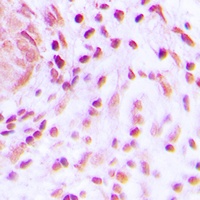 BARD1 Rabbit Polyclonal Antibody