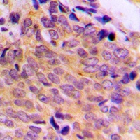 BAX Rabbit Polyclonal Antibody