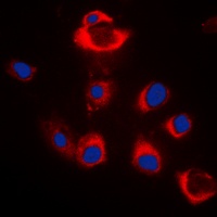 BAX Rabbit Polyclonal Antibody