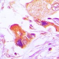 BCL2 (Phospho-S70) Rabbit Polyclonal Antibody