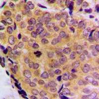BCLW Rabbit Polyclonal Antibody