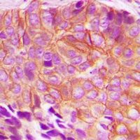 BIK (Phospho-T33) Rabbit Polyclonal Antibody