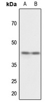 CD147 Rabbit Polyclonal Antibody
