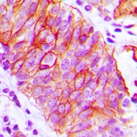 CD147 Rabbit Polyclonal Antibody