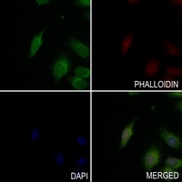 BTK (Phospho-Y223) Rabbit Polyclonal Antibody