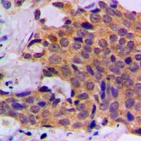 Caspase 1 Rabbit Polyclonal Antibody