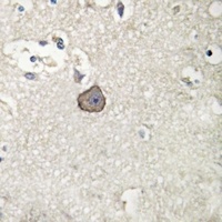 M Cadherin Rabbit Polyclonal Antibody