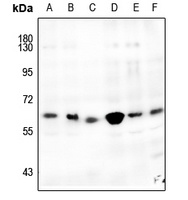 CDK8 Rabbit Polyclonal Antibody