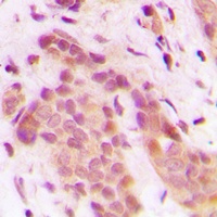 CDK8 Rabbit Polyclonal Antibody