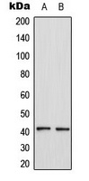 CCR4 Rabbit Polyclonal Antibody