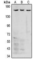 Collagen 4 alpha 5 Rabbit Polyclonal Antibody