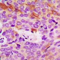 Collagen 4 alpha 5 Rabbit Polyclonal Antibody