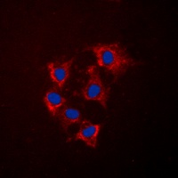 Collagen 4 alpha 5 Rabbit Polyclonal Antibody